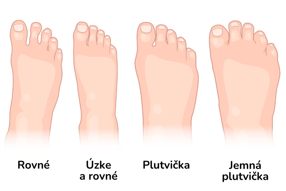 SK  Typy chodidel - tvar chodidla